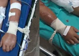 Pacientes com Covid são amarrados a macas no Amazonas por falta de sedativo